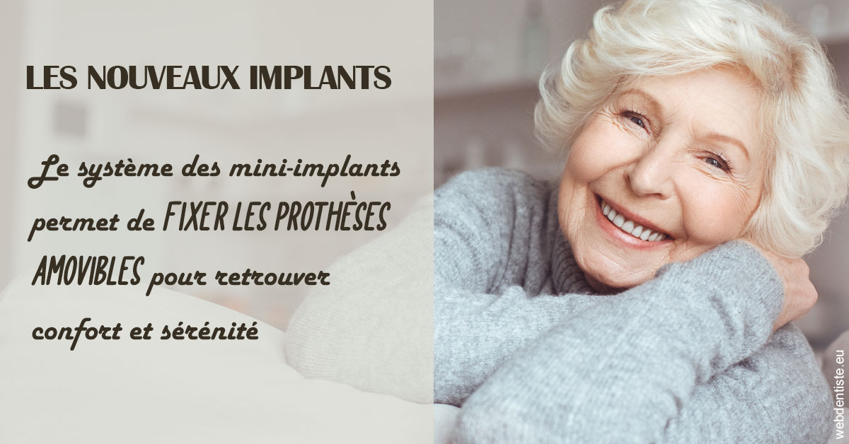 https://selarl-cabinet-dentaire-pujol.chirurgiens-dentistes.fr/Les nouveaux implants 1