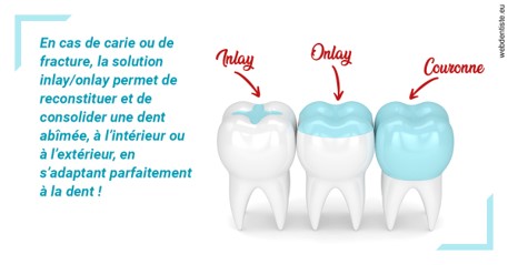 https://selarl-cabinet-dentaire-pujol.chirurgiens-dentistes.fr/L'INLAY ou l'ONLAY