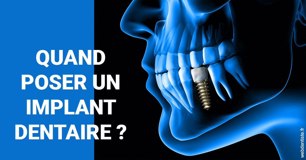 https://selarl-cabinet-dentaire-pujol.chirurgiens-dentistes.fr/Les implants 1
