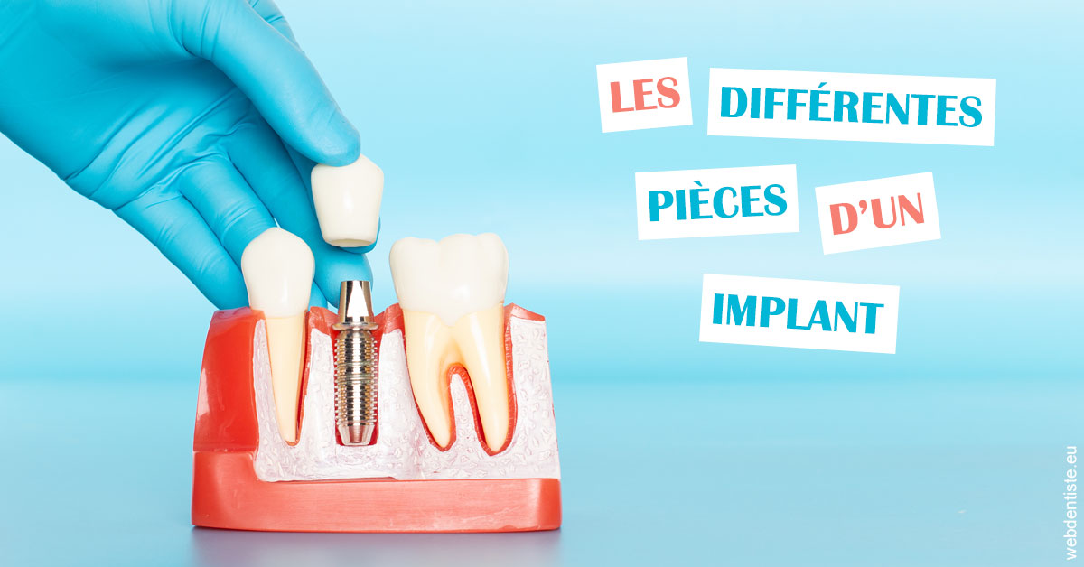 https://selarl-cabinet-dentaire-pujol.chirurgiens-dentistes.fr/Les différentes pièces d’un implant 2
