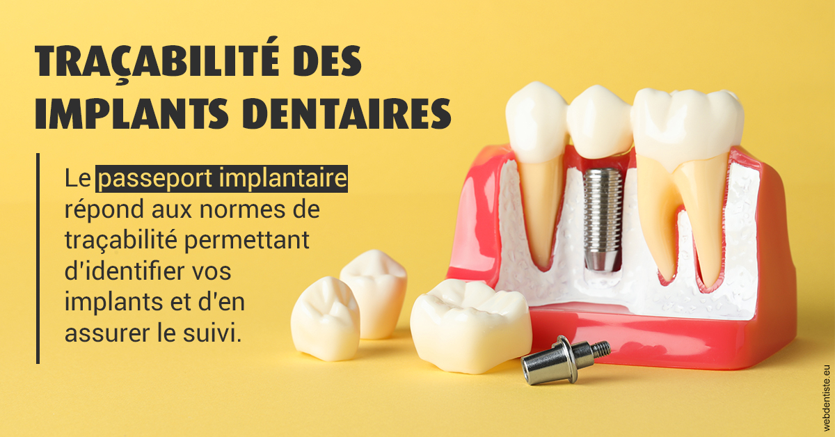 https://selarl-cabinet-dentaire-pujol.chirurgiens-dentistes.fr/T2 2023 - Traçabilité des implants 2