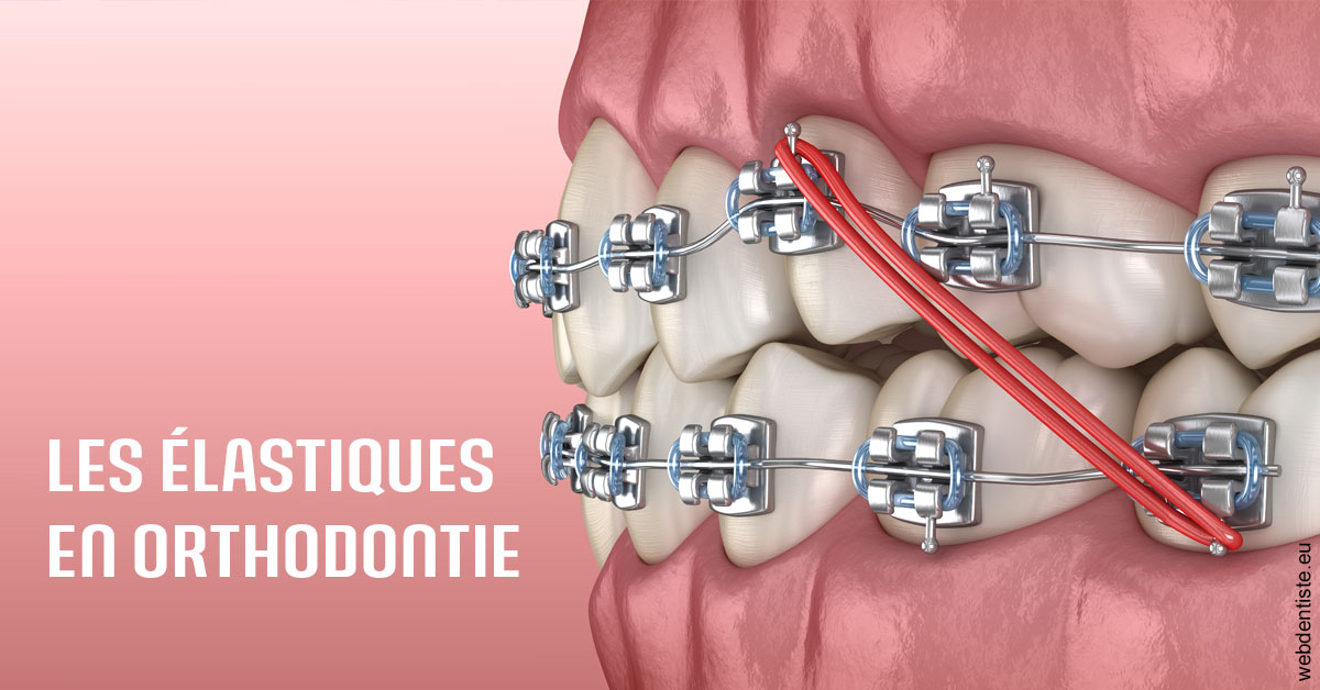 https://selarl-cabinet-dentaire-pujol.chirurgiens-dentistes.fr/Elastiques orthodontie 2
