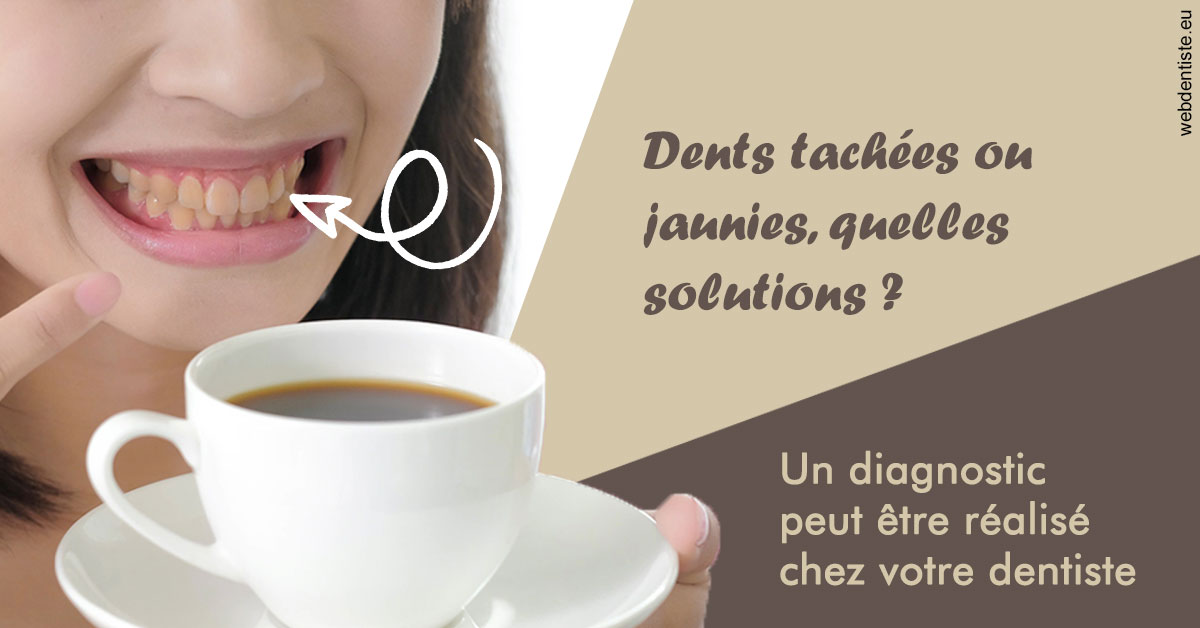 https://selarl-cabinet-dentaire-pujol.chirurgiens-dentistes.fr/Dents tachées 1