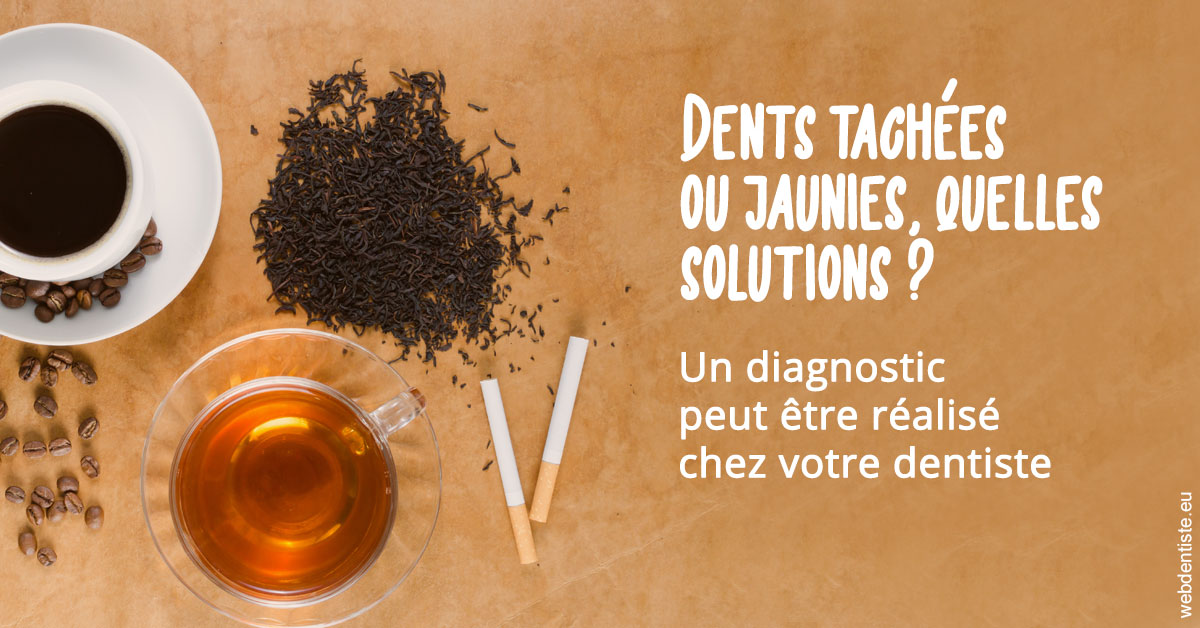 https://selarl-cabinet-dentaire-pujol.chirurgiens-dentistes.fr/Dents tachées 2