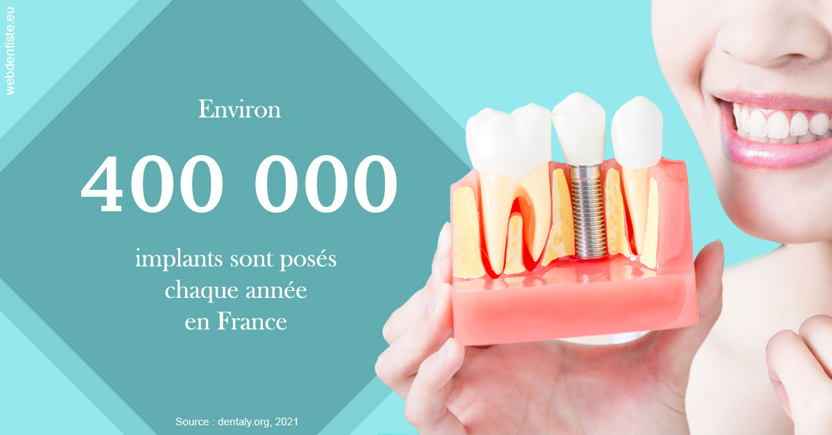 https://selarl-cabinet-dentaire-pujol.chirurgiens-dentistes.fr/Pose d'implants en France 2